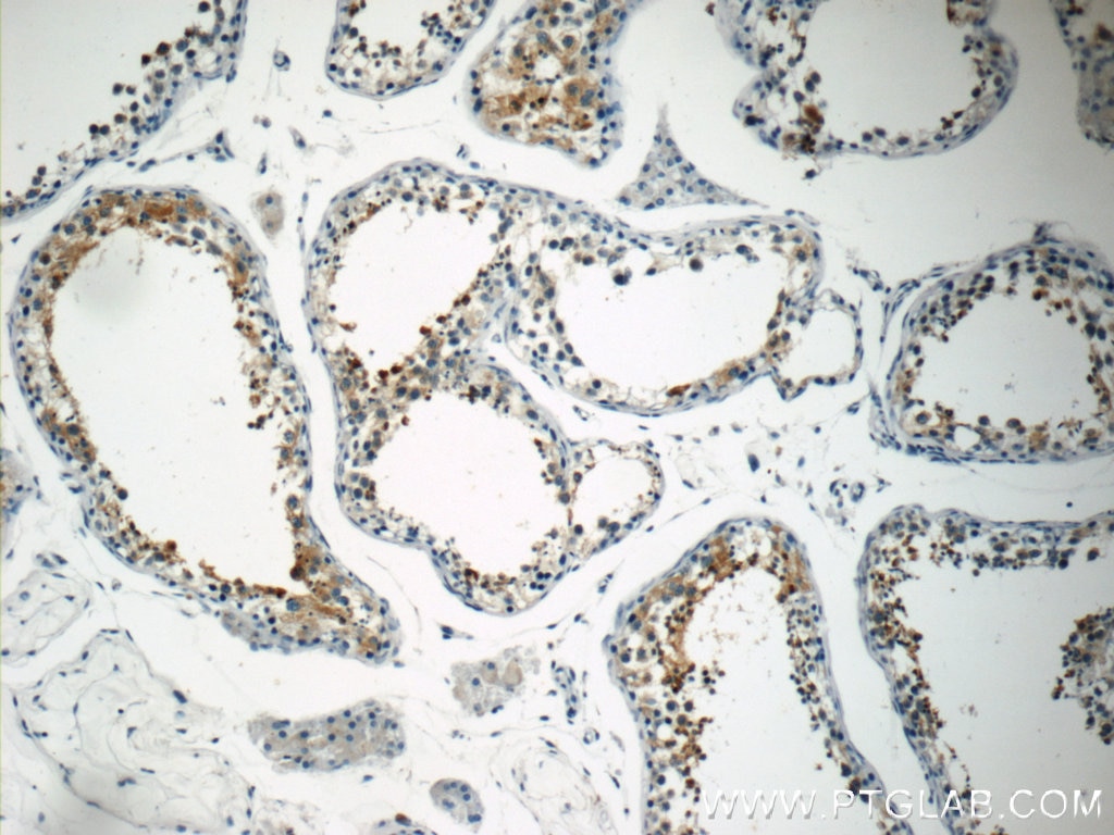 Immunohistochemistry (IHC) staining of human testis tissue using PABPC1,PABP Polyclonal antibody (10970-1-AP)