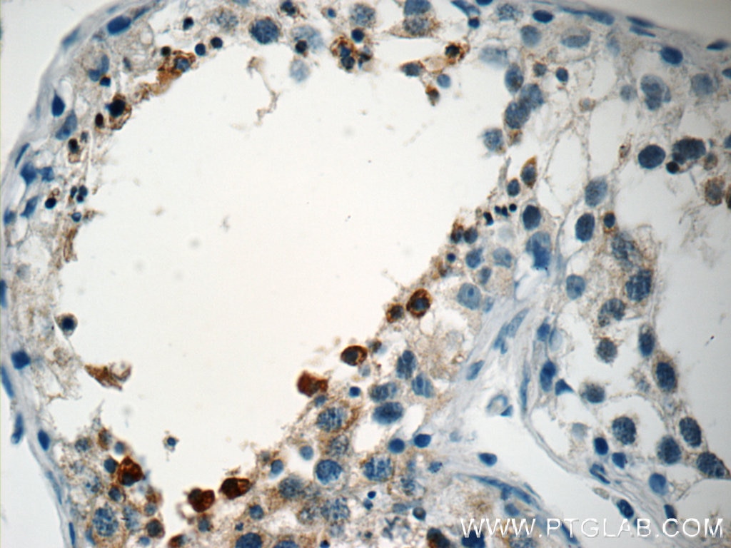 Immunohistochemistry (IHC) staining of human testis tissue using PABPC1,PABP Polyclonal antibody (10970-1-AP)