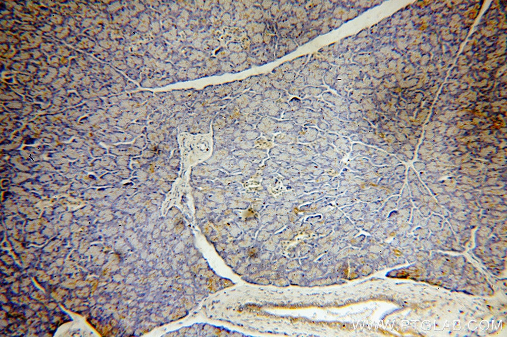 IHC staining of human pancreas using 10970-1-AP