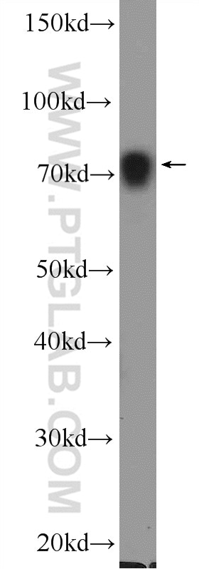 Western Blot (WB) analysis of rat testis tissue using PABPC1,PABP Polyclonal antibody (10970-1-AP)