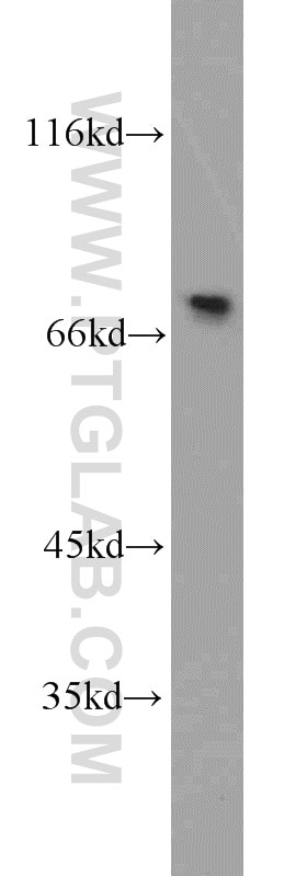 Western Blot (WB) analysis of mouse testis tissue using PABPC1,PABP Polyclonal antibody (10970-1-AP)