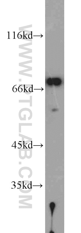 PABPC1,PABP Polyclonal antibody