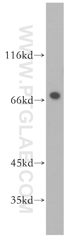 Western Blot (WB) analysis of PC-3 cells using PABPC1,PABP Polyclonal antibody (10970-1-AP)