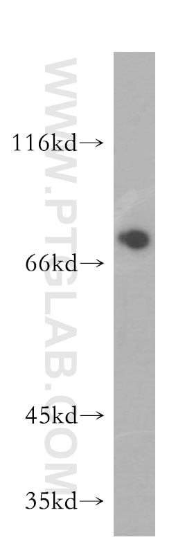 Western Blot (WB) analysis of mouse testis tissue using PABPC1,PABP Polyclonal antibody (10970-1-AP)