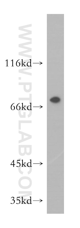 Western Blot (WB) analysis of HeLa cells using PABPC1,PABP Polyclonal antibody (10970-1-AP)