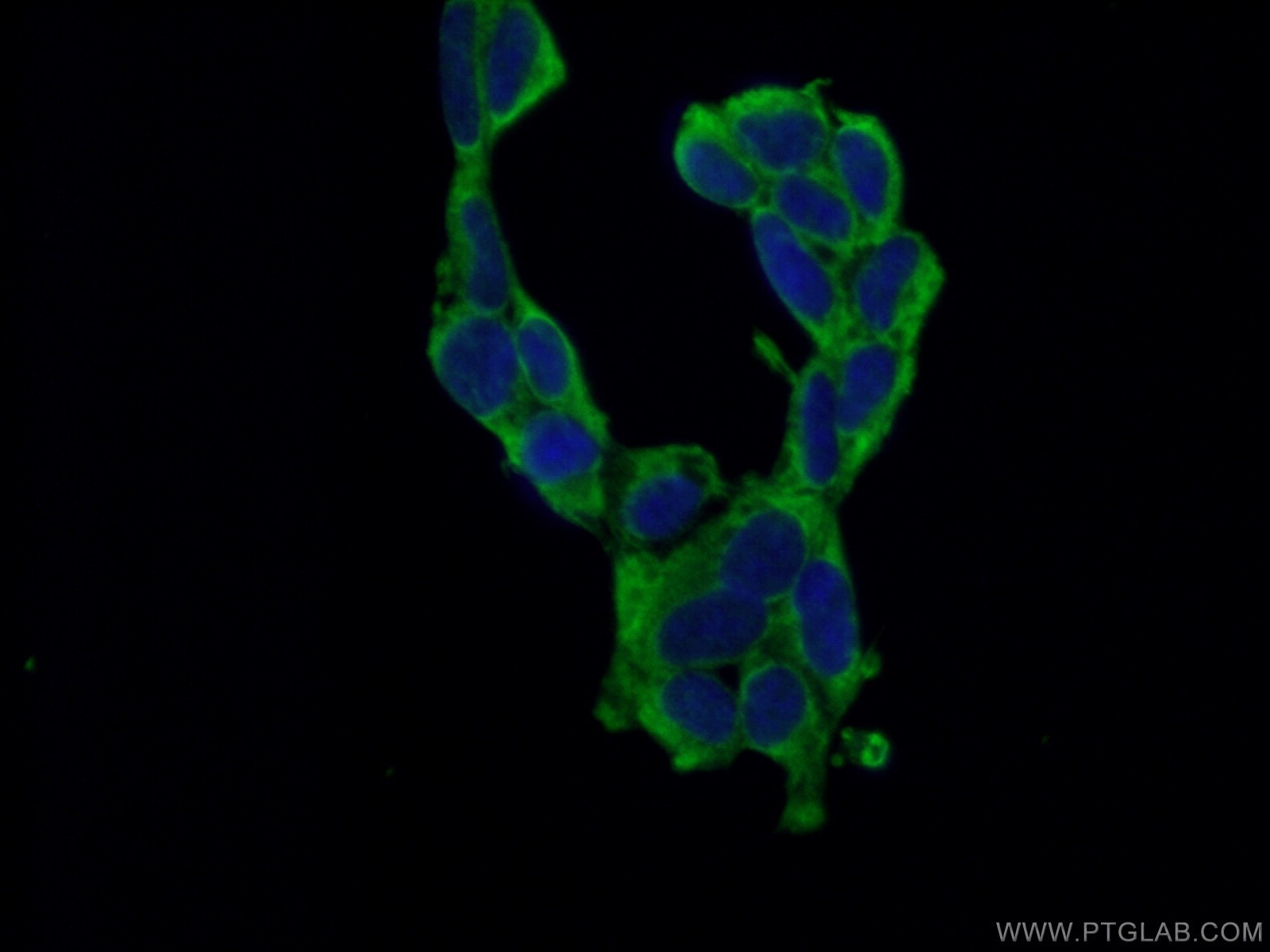 Immunofluorescence (IF) / fluorescent staining of HEK-293 cells using PABPC1,PABP Monoclonal antibody (66809-1-Ig)