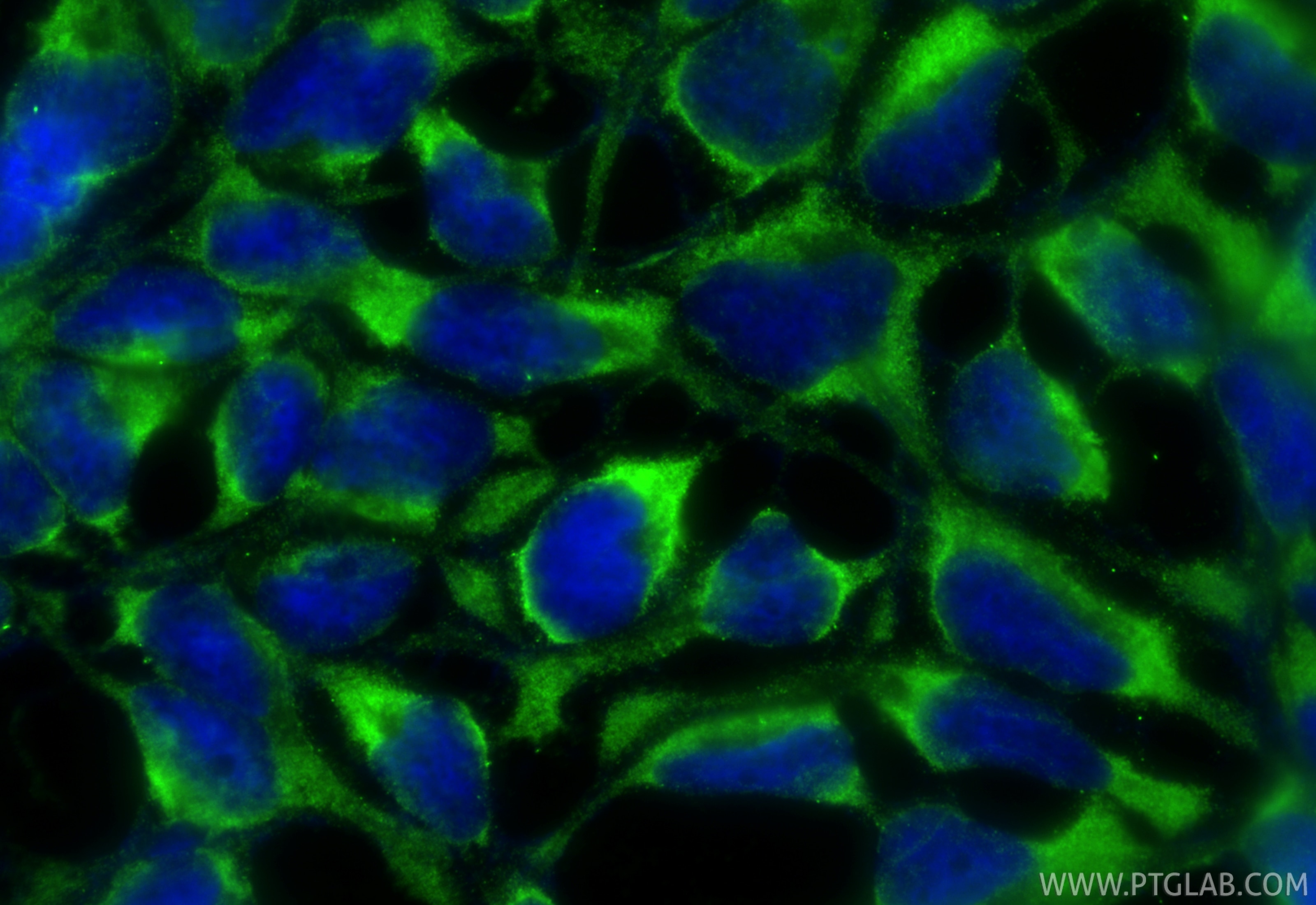 Immunofluorescence (IF) / fluorescent staining of HEK-293 cells using PABPC1,PABP Monoclonal antibody (66809-1-Ig)