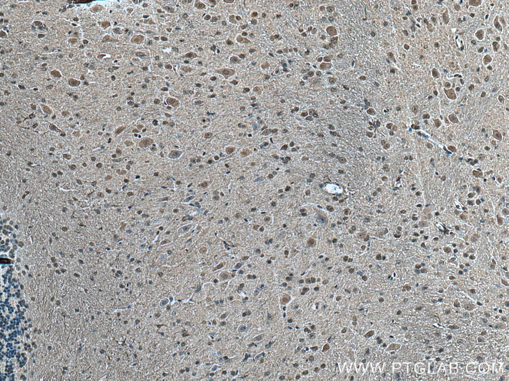 Immunohistochemistry (IHC) staining of mouse cerebellum tissue using PABPC1,PABP Monoclonal antibody (66809-1-Ig)
