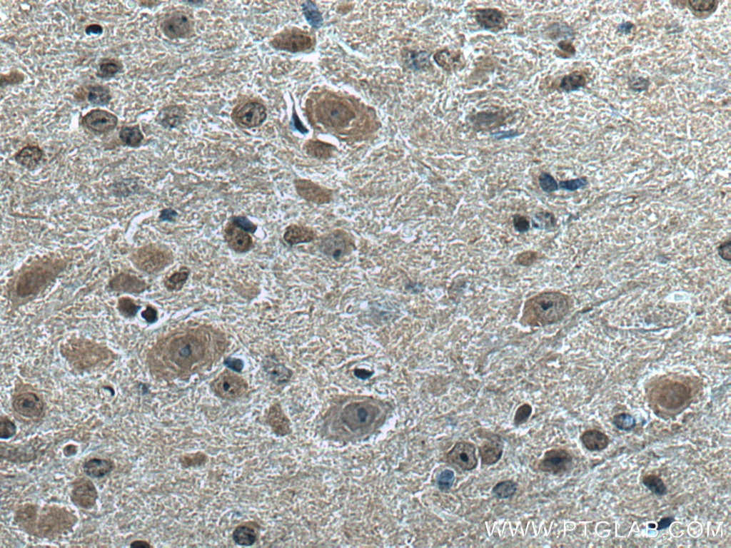 Immunohistochemistry (IHC) staining of mouse cerebellum tissue using PABPC1,PABP Monoclonal antibody (66809-1-Ig)