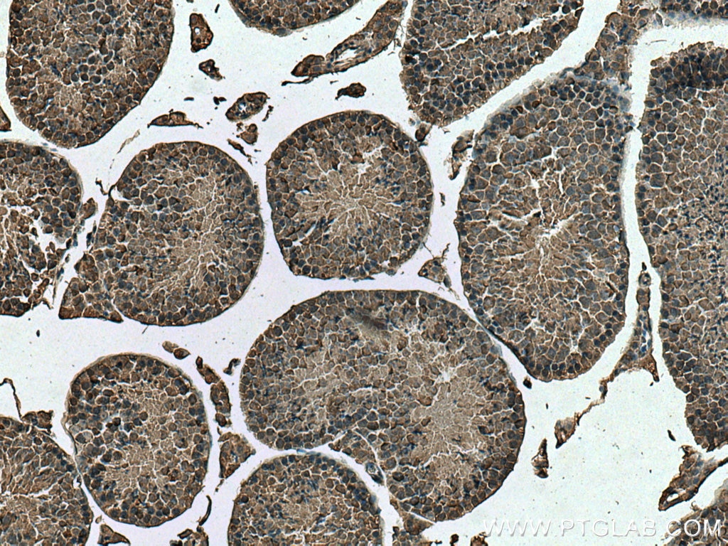 Immunohistochemistry (IHC) staining of mouse testis tissue using PABPC1,PABP Monoclonal antibody (66809-1-Ig)
