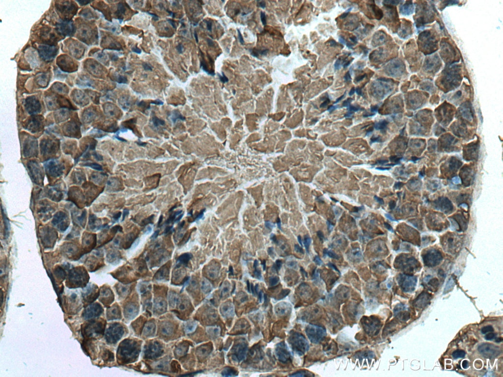 Immunohistochemistry (IHC) staining of mouse testis tissue using PABPC1,PABP Monoclonal antibody (66809-1-Ig)