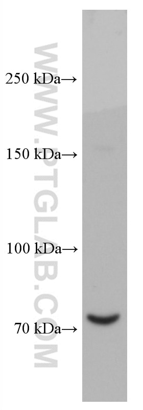 Western Blot (WB) analysis of LNCaP cells using PABPC1,PABP Monoclonal antibody (66809-1-Ig)