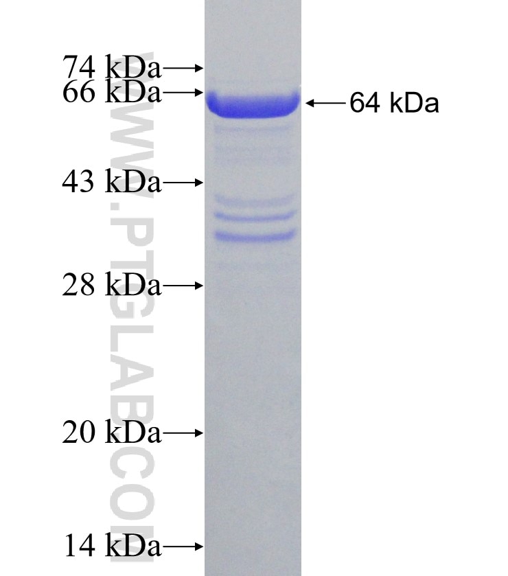 PABPC1,PABP fusion protein Ag1422 SDS-PAGE