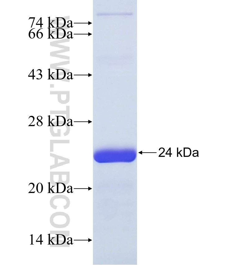 PABPC1L fusion protein Ag36248 SDS-PAGE