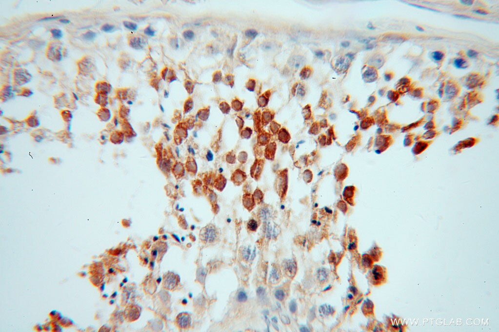 Immunohistochemistry (IHC) staining of human testis tissue using PABPC3 Polyclonal antibody (12625-2-AP)