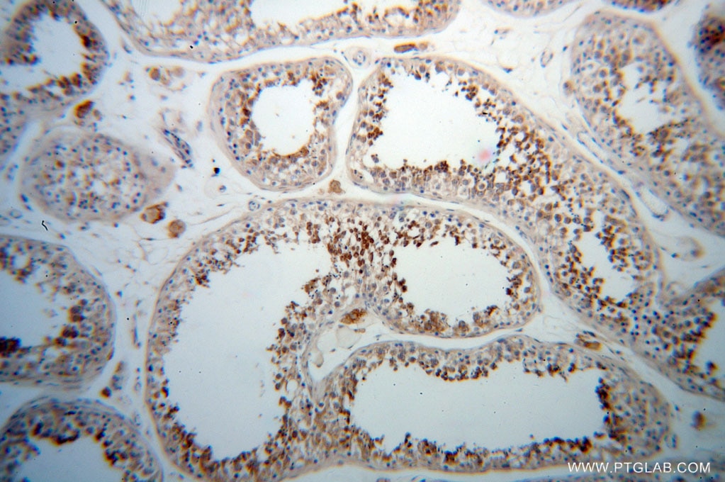 Immunohistochemistry (IHC) staining of human testis tissue using PABPC3 Polyclonal antibody (12625-2-AP)