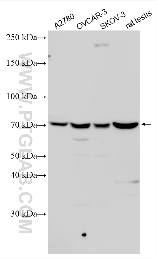 Various lysates were subjected to SDS PAGE followed by western blot with 12625-2-AP (PABPC3 antibody) at dilution of 1:600 incubated at room temperature for 1.5 hours. Western Blot (WB) analysis of various lysates using PABPC3 Polyclonal antibody (12625-2-AP)