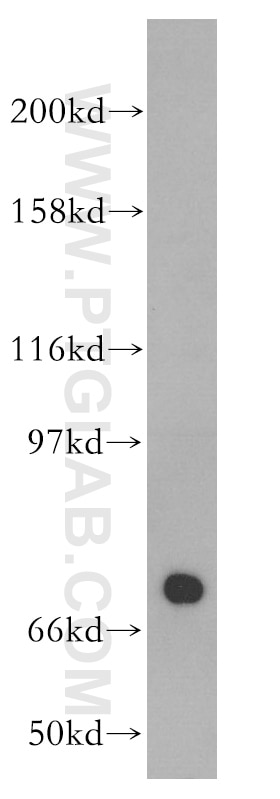 Western Blot (WB) analysis of mouse testis tissue using PABPC3 Polyclonal antibody (12625-2-AP)