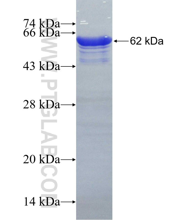 PABPC3 fusion protein Ag3317 SDS-PAGE