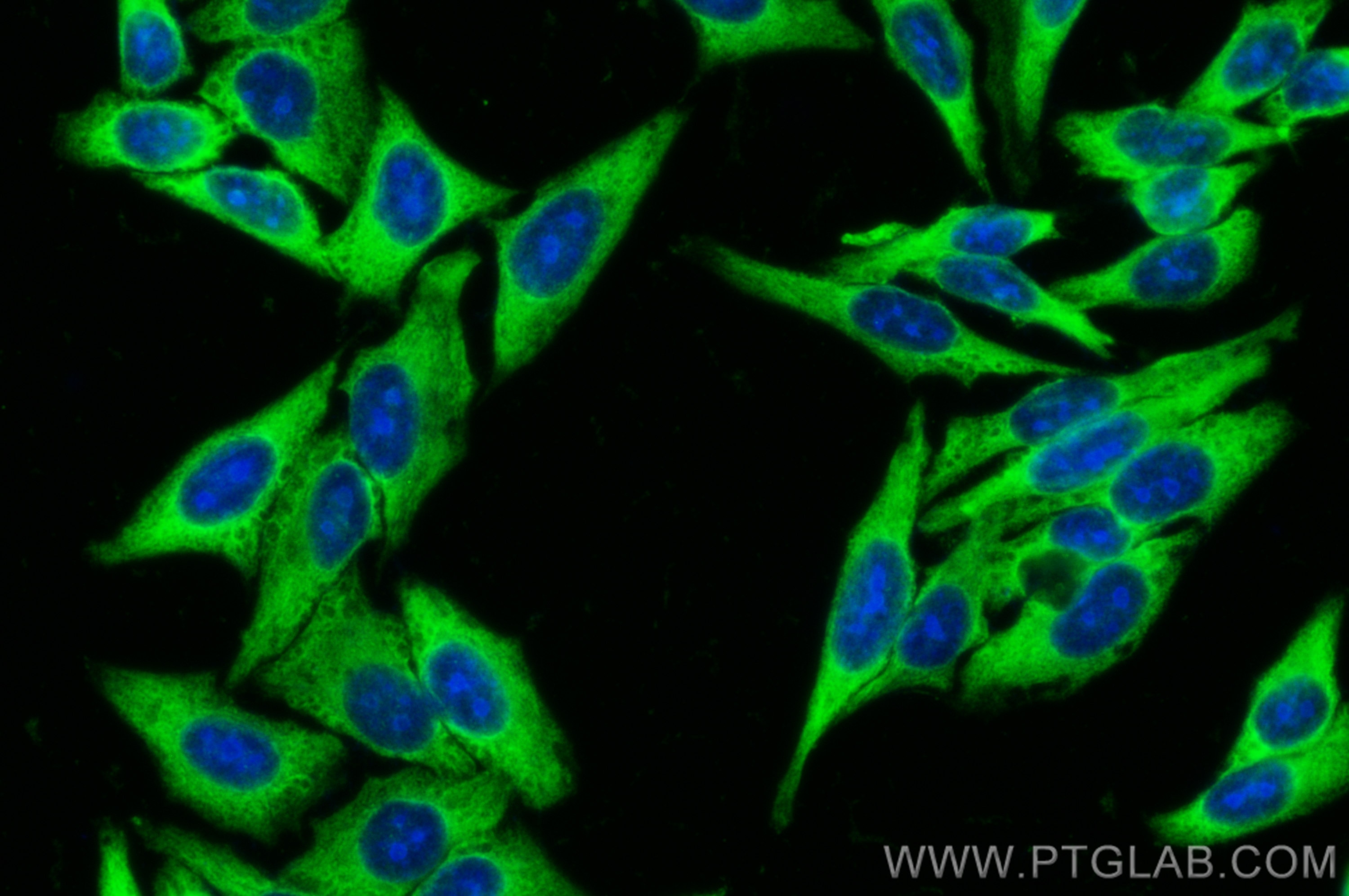Immunofluorescence (IF) / fluorescent staining of HepG2 cells using PABPC4 Polyclonal antibody (14960-1-AP)