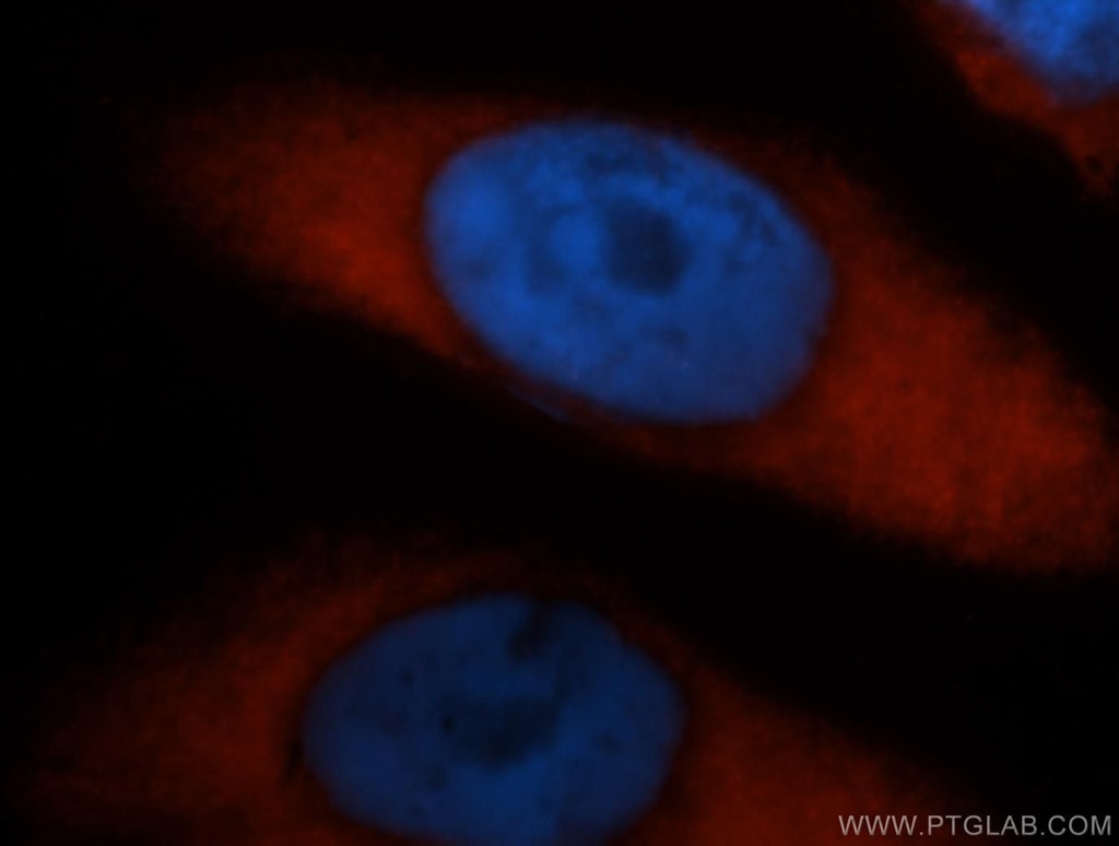 Immunofluorescence (IF) / fluorescent staining of HeLa cells using PABPC4 Polyclonal antibody (14960-1-AP)