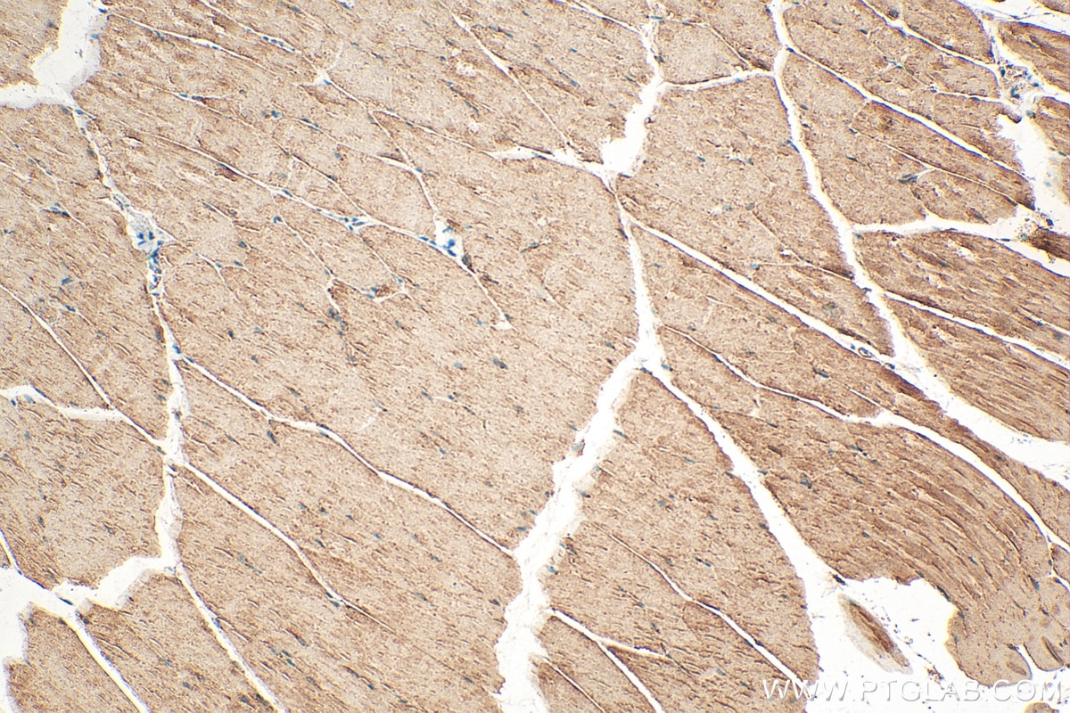 Immunohistochemistry (IHC) staining of mouse skeletal muscle tissue using PABPC4 Polyclonal antibody (14960-1-AP)