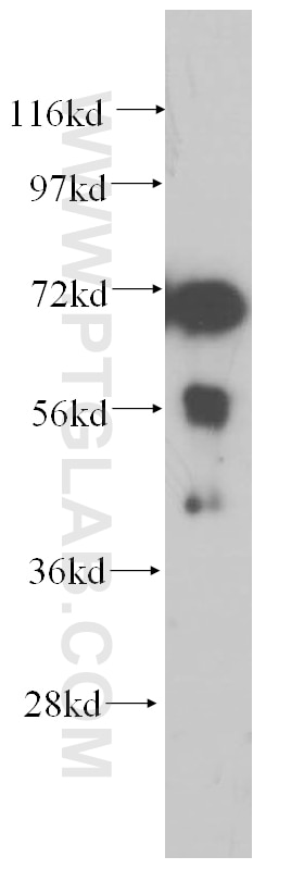Western Blot (WB) analysis of mouse heart tissue using PABPC4 Polyclonal antibody (14960-1-AP)