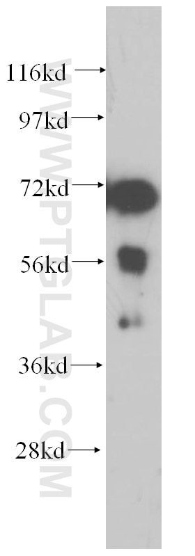 WB analysis of mouse heart using 14960-1-AP