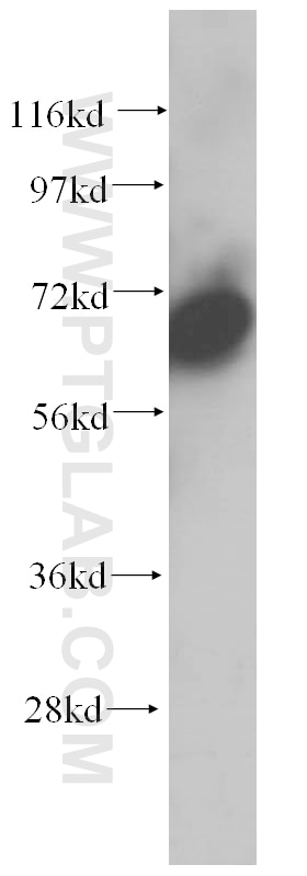 Western Blot (WB) analysis of human brain tissue using PABPC4 Polyclonal antibody (14960-1-AP)
