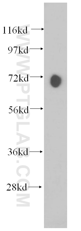 Western Blot (WB) analysis of Jurkat cells using PABPC4 Polyclonal antibody (14960-1-AP)