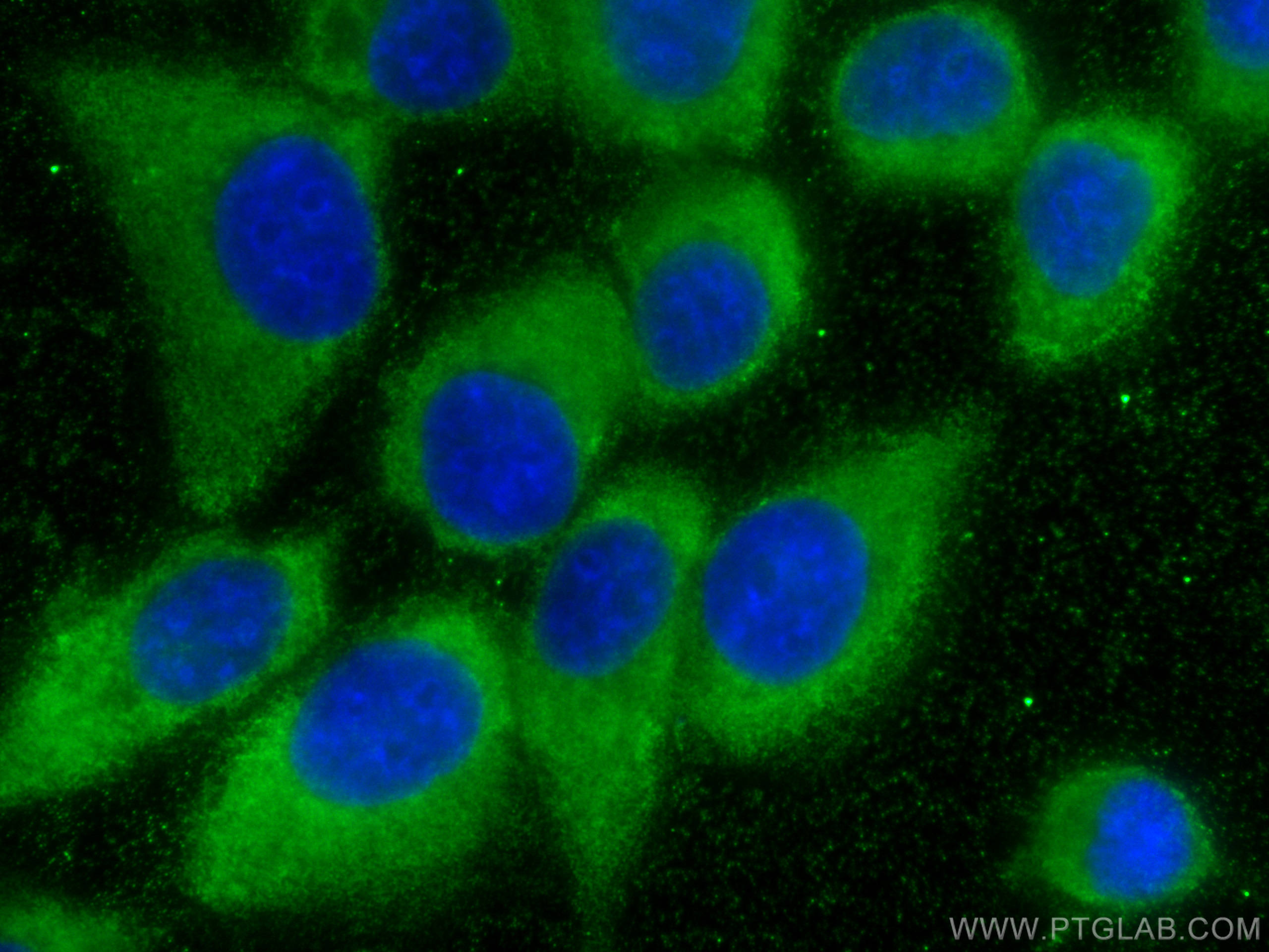 Immunofluorescence (IF) / fluorescent staining of A431 cells using PABPC4 Monoclonal antibody (68187-1-Ig)