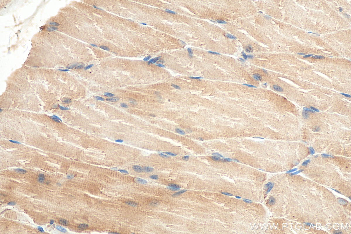 Immunohistochemistry (IHC) staining of mouse skeletal muscle tissue using PABPC4 Monoclonal antibody (68187-1-Ig)