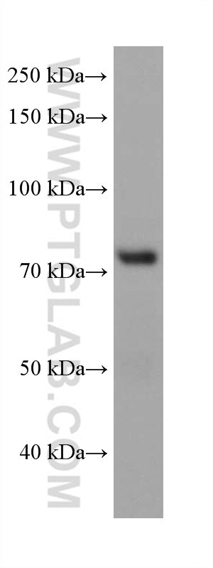 Western Blot (WB) analysis of NIH/3T3 cells using PABPC4 Monoclonal antibody (68187-1-Ig)