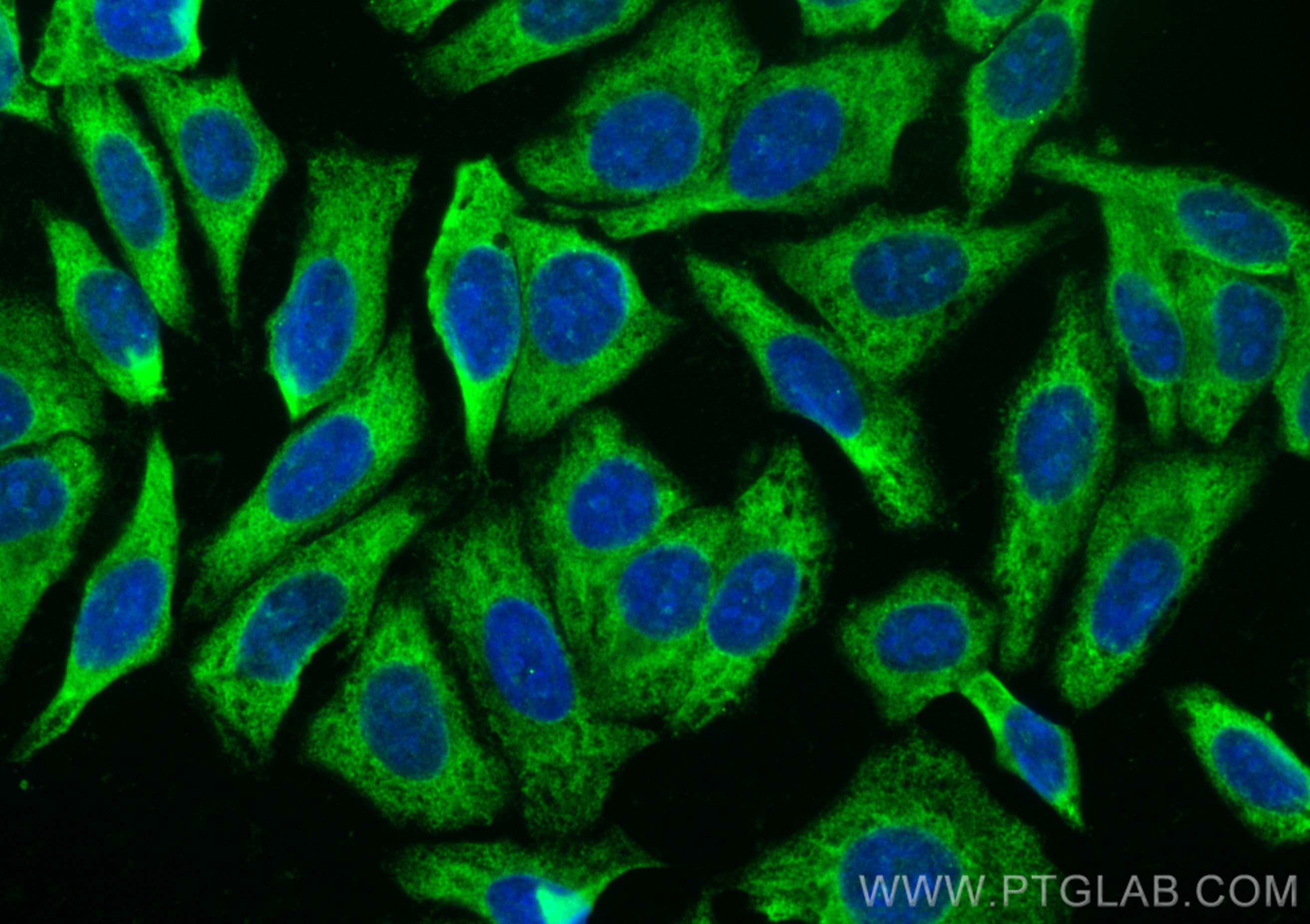 Immunofluorescence (IF) / fluorescent staining of HepG2 cells using CoraLite® Plus 488-conjugated PABPC4 Polyclonal an (CL488-14960)