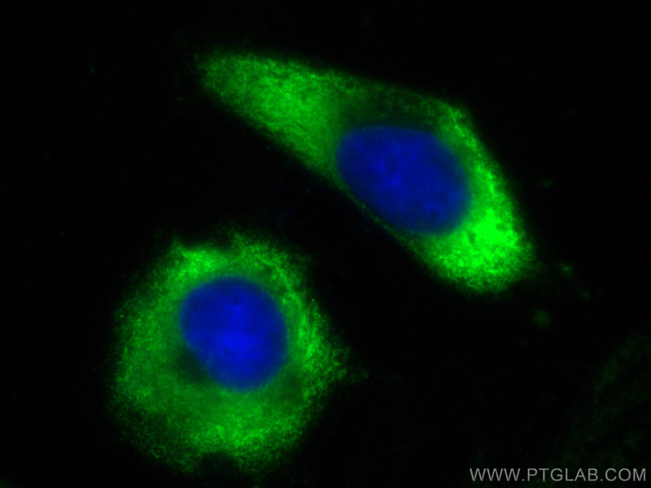 Immunofluorescence (IF) / fluorescent staining of HeLa cells using CoraLite® Plus 488-conjugated PABPC4 Polyclonal an (CL488-14960)