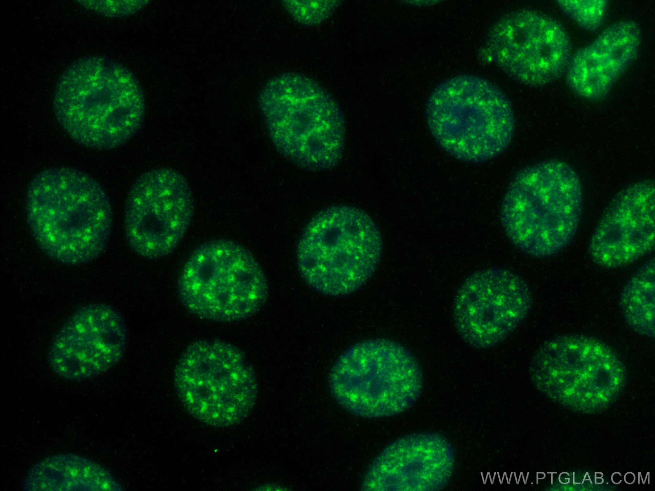 Immunofluorescence (IF) / fluorescent staining of MCF-7 cells using PABPN1 Monoclonal antibody (66807-1-Ig)