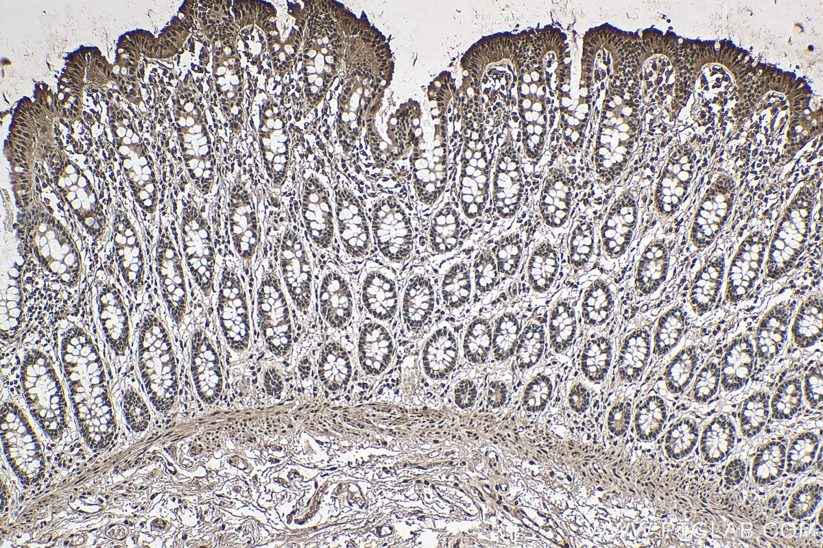 Immunohistochemistry (IHC) staining of human colon tissue using PABPN1 Monoclonal antibody (66807-1-Ig)