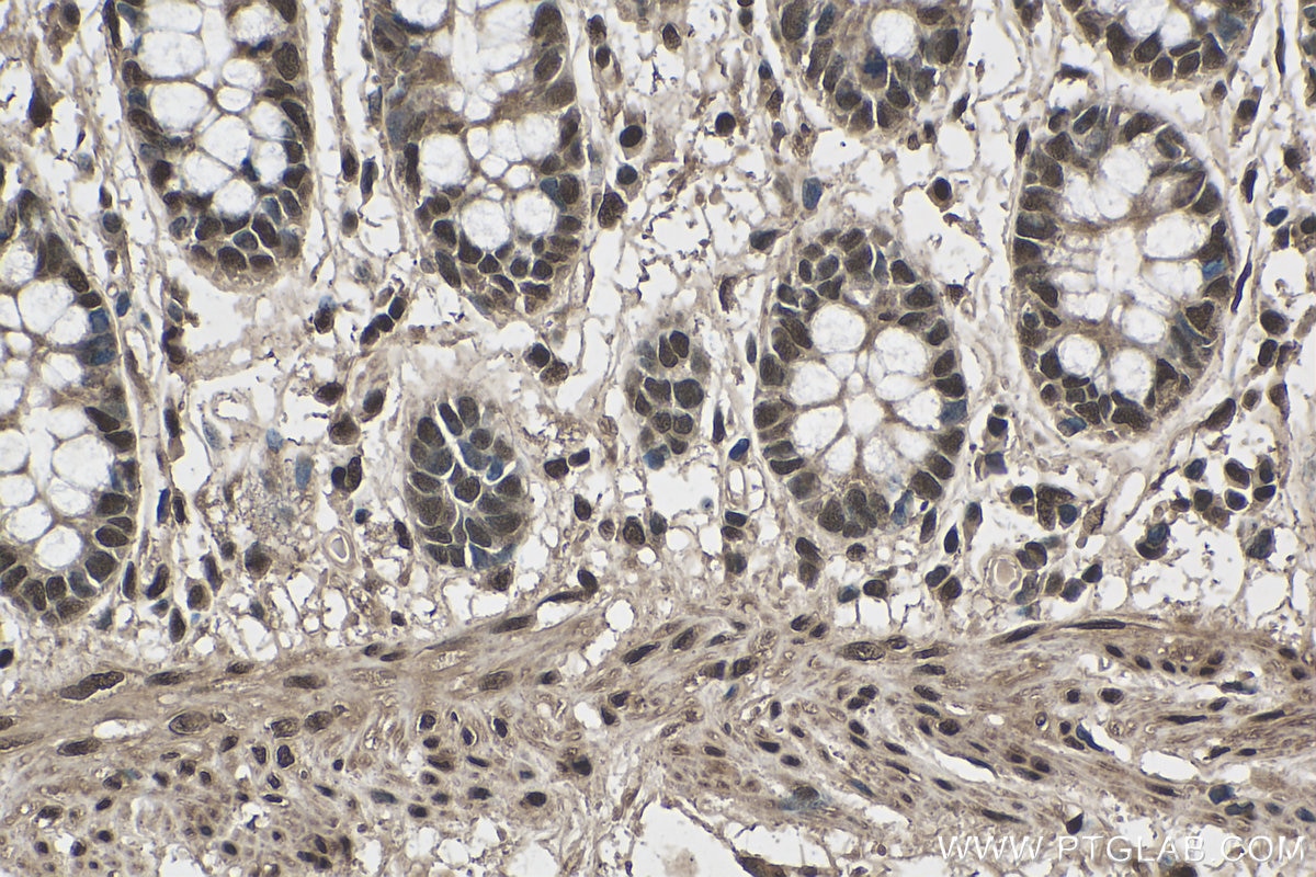 Immunohistochemistry (IHC) staining of human colon tissue using PABPN1 Monoclonal antibody (66807-1-Ig)