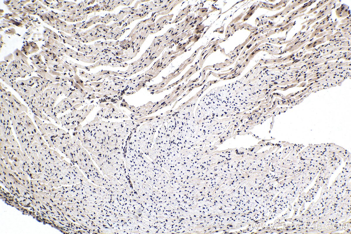 Immunohistochemistry (IHC) staining of mouse heart tissue using PABPN1 Monoclonal antibody (66807-1-Ig)