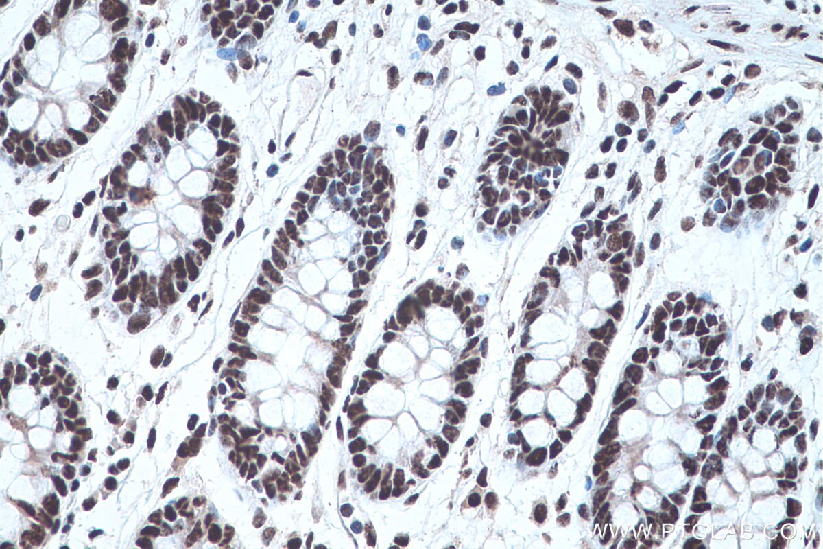 Immunohistochemistry (IHC) staining of human colon tissue using PABPN1 Monoclonal antibody (66807-1-Ig)