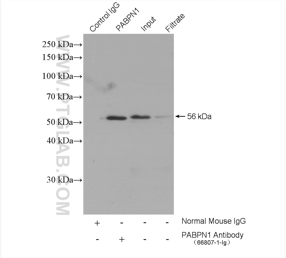 Immunoprecipitation (IP) experiment of Jurkat cells using PABPN1 Monoclonal antibody (66807-1-Ig)