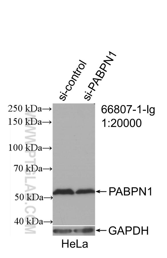 Western Blot (WB) analysis of HeLa cells using PABPN1 Monoclonal antibody (66807-1-Ig)