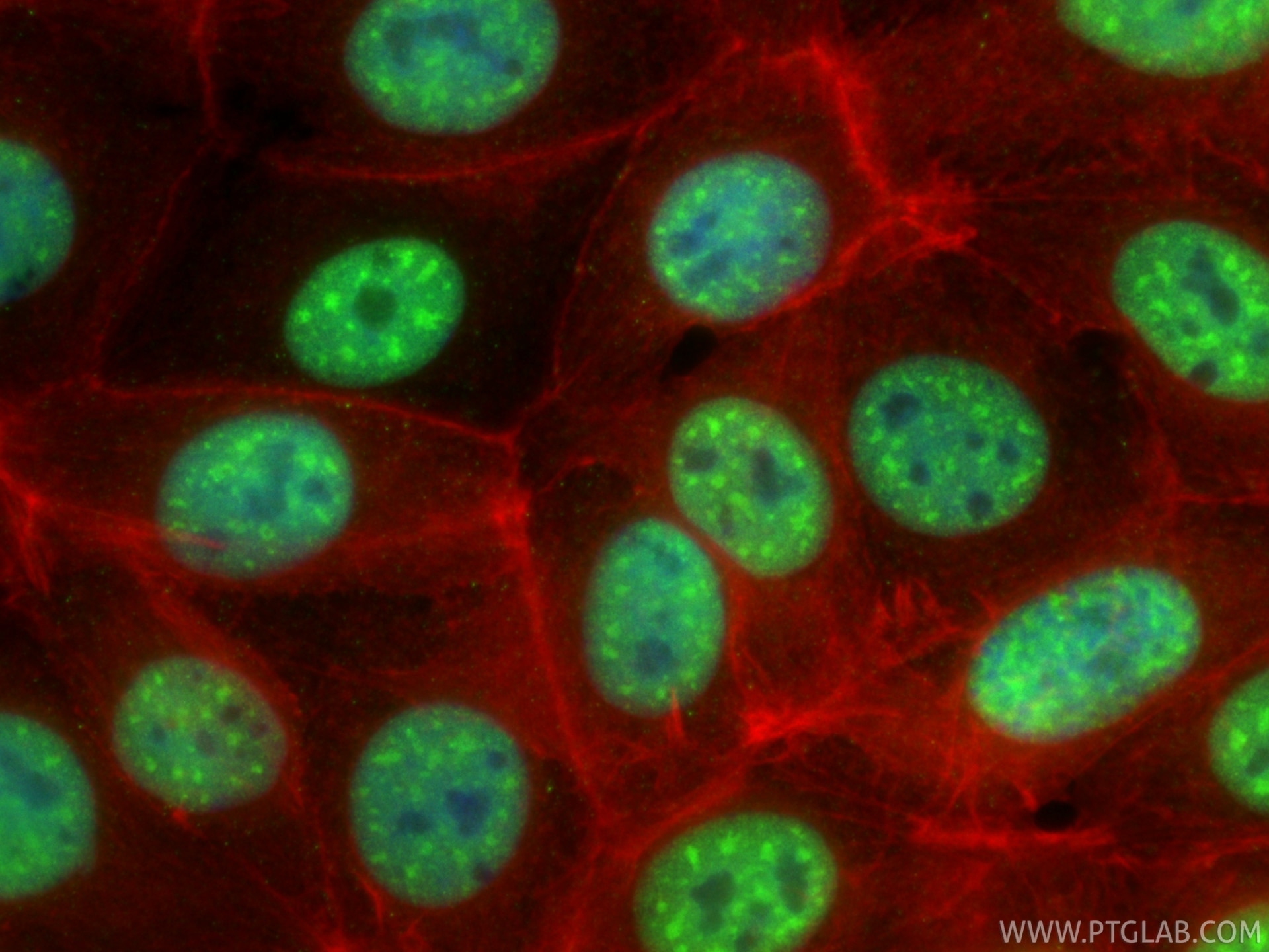 IF Staining of MCF-7 using 87392-1-RR Immunofluorescence (IF) / fluorescent staining of MCF-7 cells using PABPN1 Recombinant monoclonal antibody (87392-1-RR)