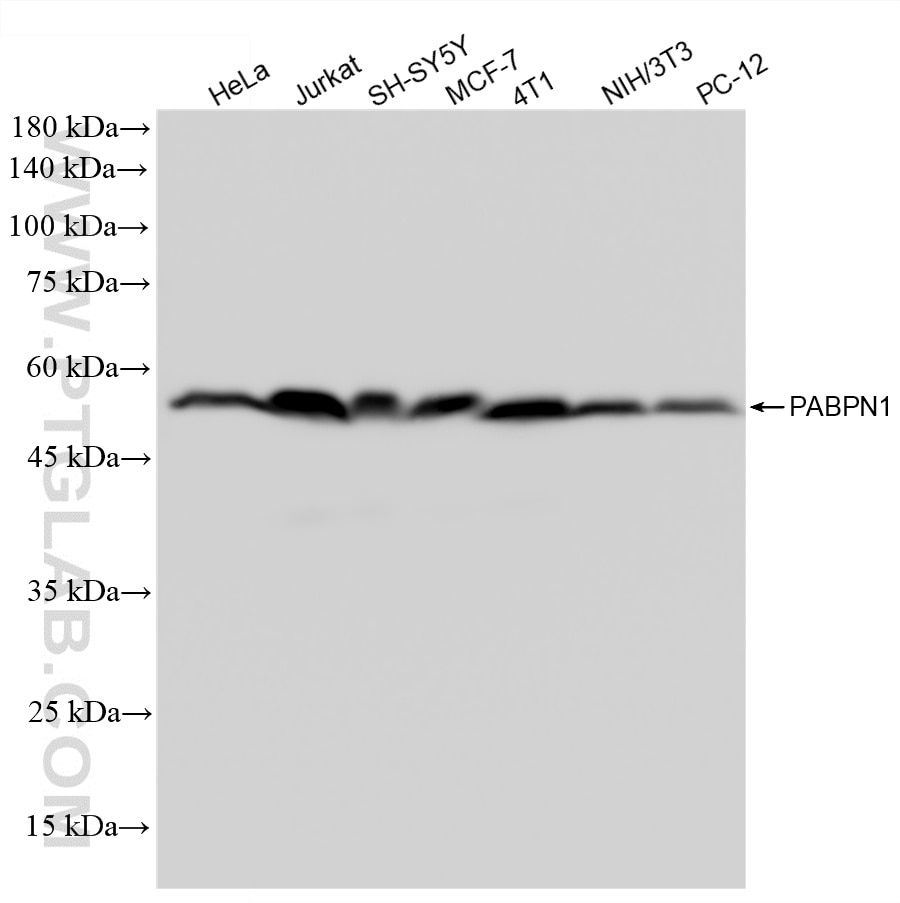Western Blot (WB) analysis of various lysates using PABPN1 Recombinant monoclonal antibody (87392-1-RR)