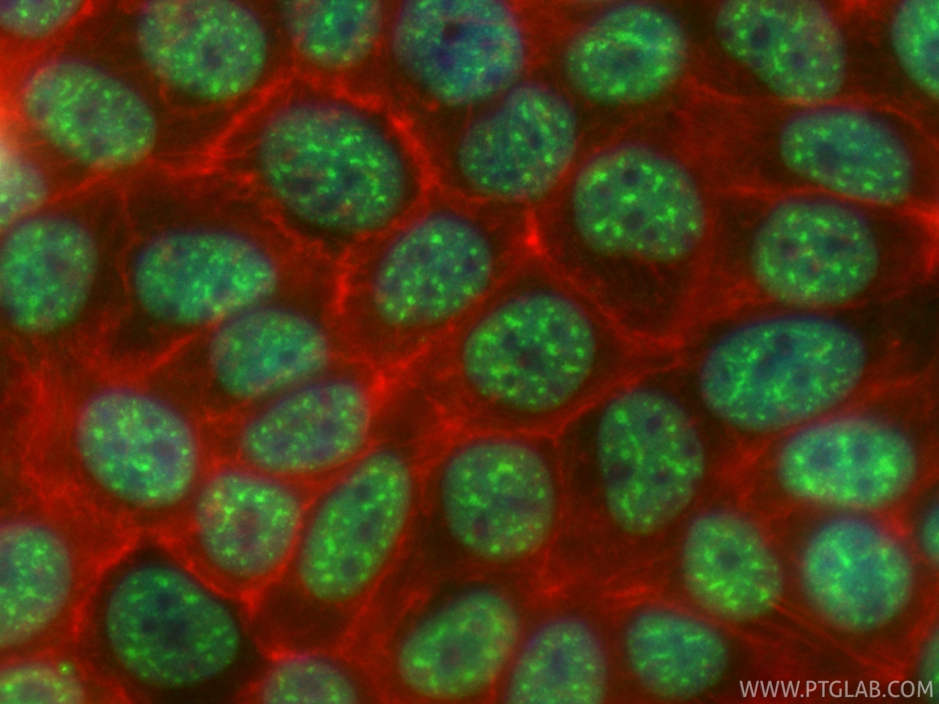 IF Staining of MCF-7 using CL488-87392 Immunofluorescence (IF) / fluorescent staining of MCF-7 cells using CoraLite® Plus 488-conjugated PABPN1 Recombinant m (CL488-87392)