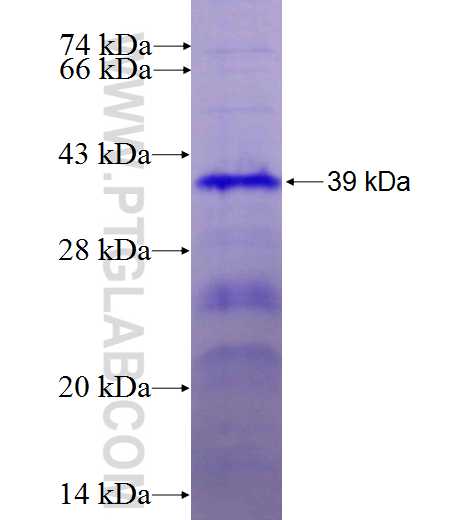 PABPN1 fusion protein Ag27470 SDS-PAGE