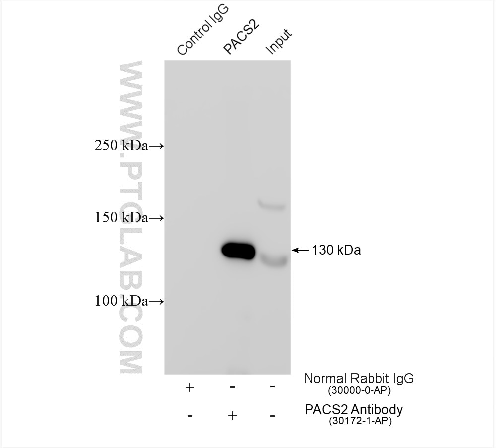 Immunoprecipitation (IP) experiment of HCT 116 cells using PACS2 Polyclonal antibody (30172-1-AP)