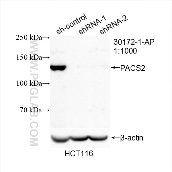 Western Blot (WB) analysis of HCT 116 cells using PACS2 Polyclonal antibody (30172-1-AP)