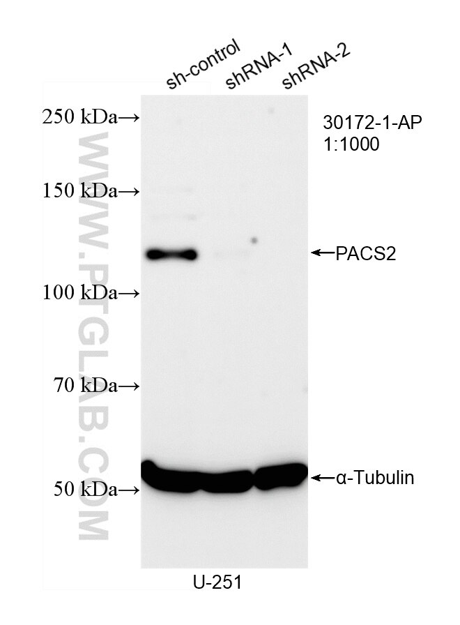 WB analysis of U-251 using 30172-1-AP Western Blot (WB) analysis of U-251 cells using PACS2 Polyclonal antibody (30172-1-AP)