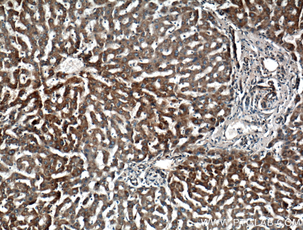 Immunohistochemistry (IHC) staining of human liver tissue using PACS2-Specific Polyclonal antibody (19508-1-AP)